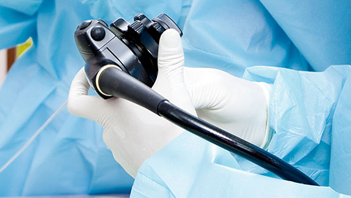 Endoscopia